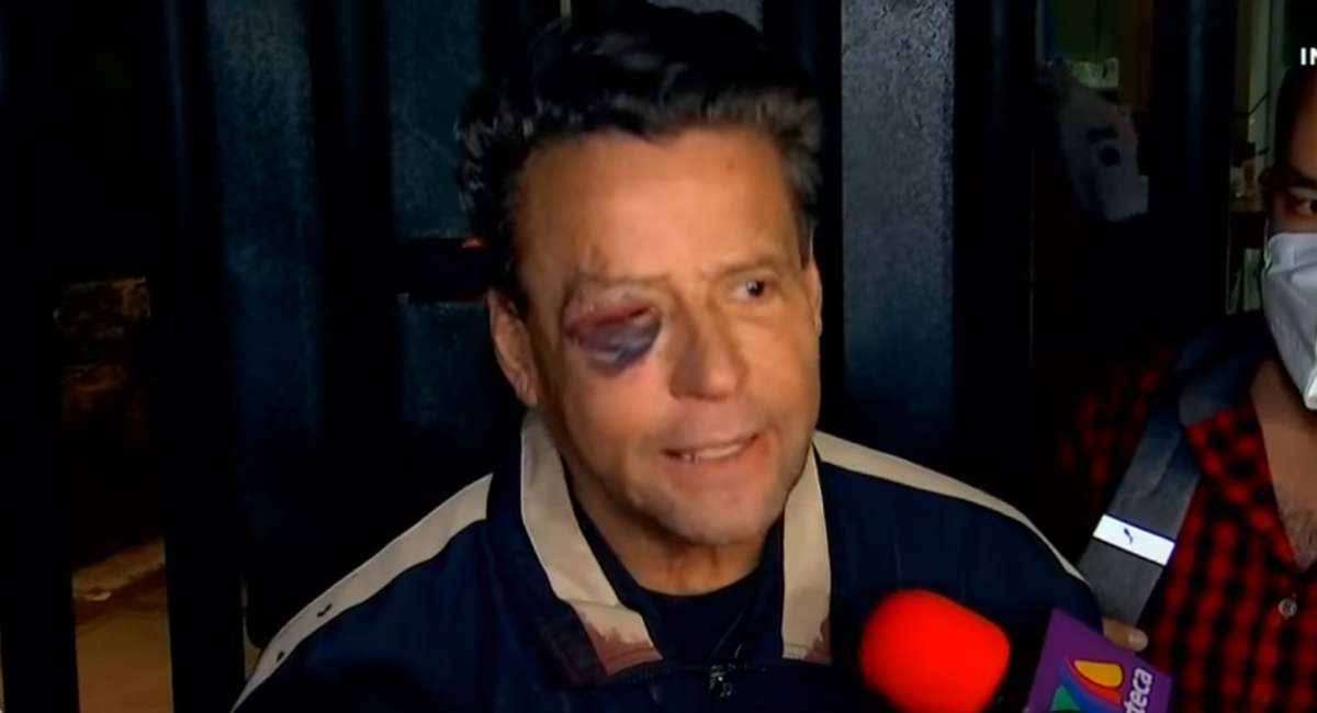 Alfredo Adame tiene 4 fracturas en el cráneo tras golpiza » Oronoticias